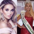 Enjoy Celebrity Radio’s LUISSA BURTON Interview – MISS EUROPE WORLD… Luissa, who sufferers from eczema and psoriasis, is the current Miss Europe World 2018. She […]